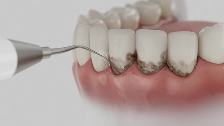 Reliable Dental Implants contractor in Cordova, NC by Smile Center Dentistry